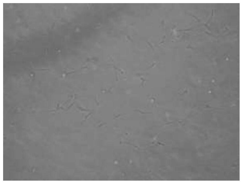 Method for three-dimensionally culturing bone marrow mesenchymal stem cells based on Collagel scaffold method