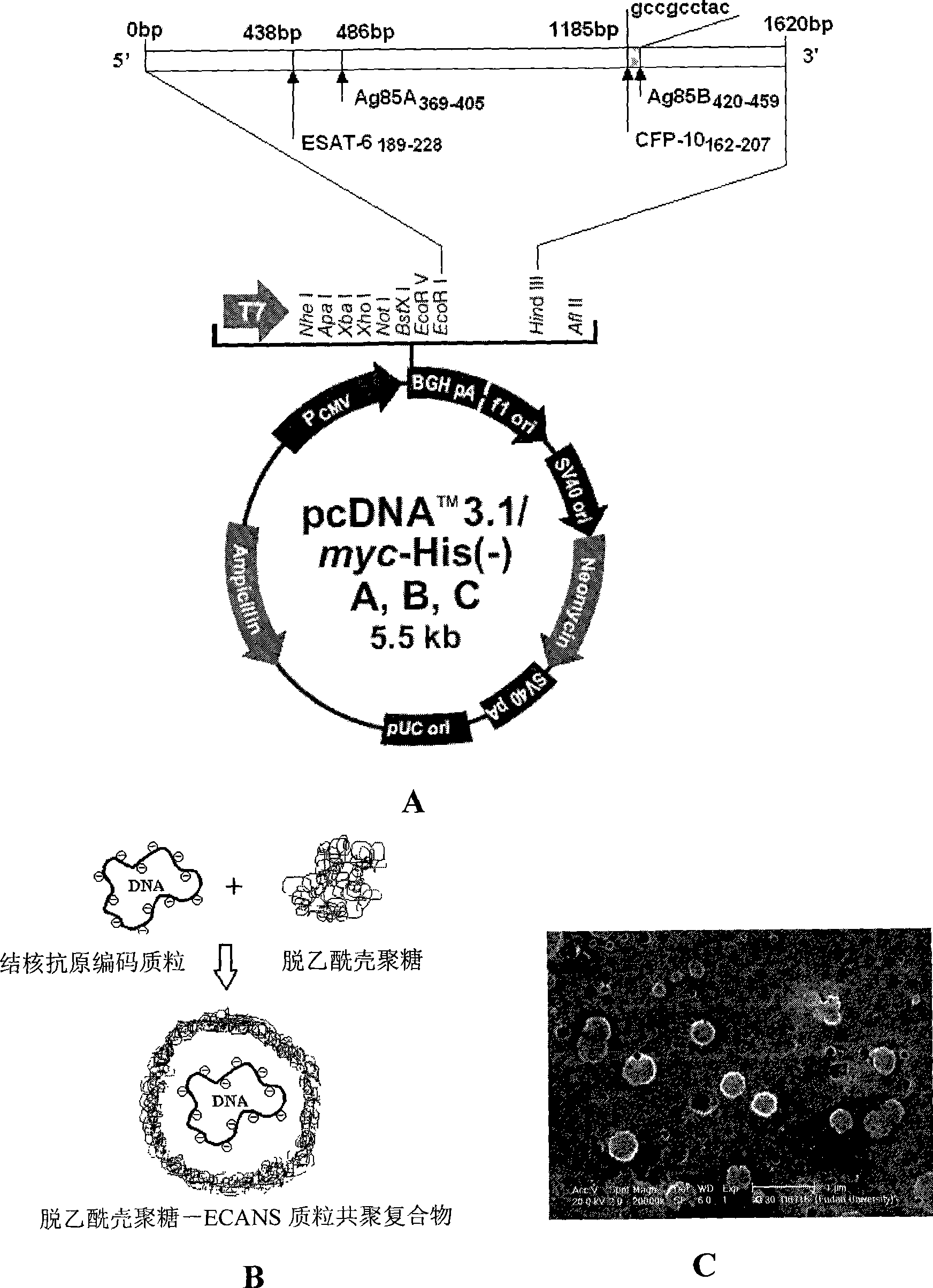 Tuberculosis gene vaccine assembled by chitosan delivery system and preparation method and use thereof