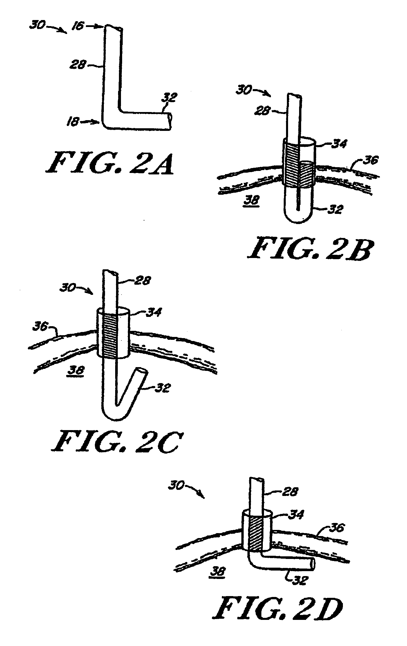 Tissue positioning systems and methods for use with radiation therapy