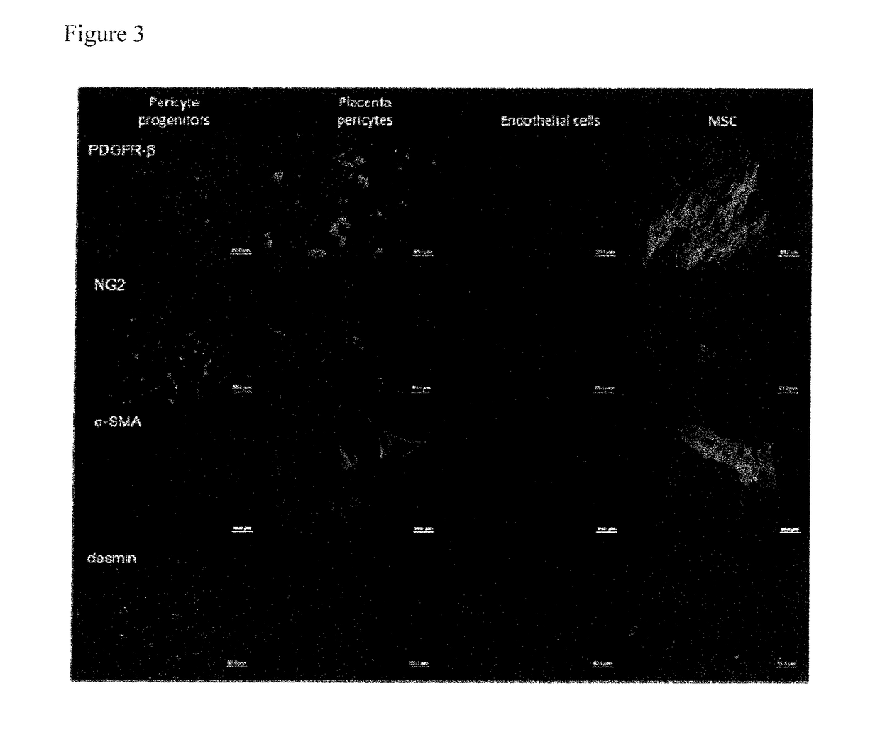 Pericyte progenitors from peripheral blood