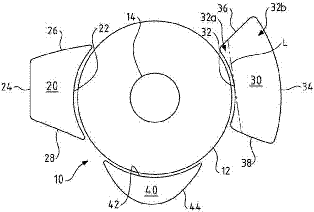 Interpositional ophthalmological implant