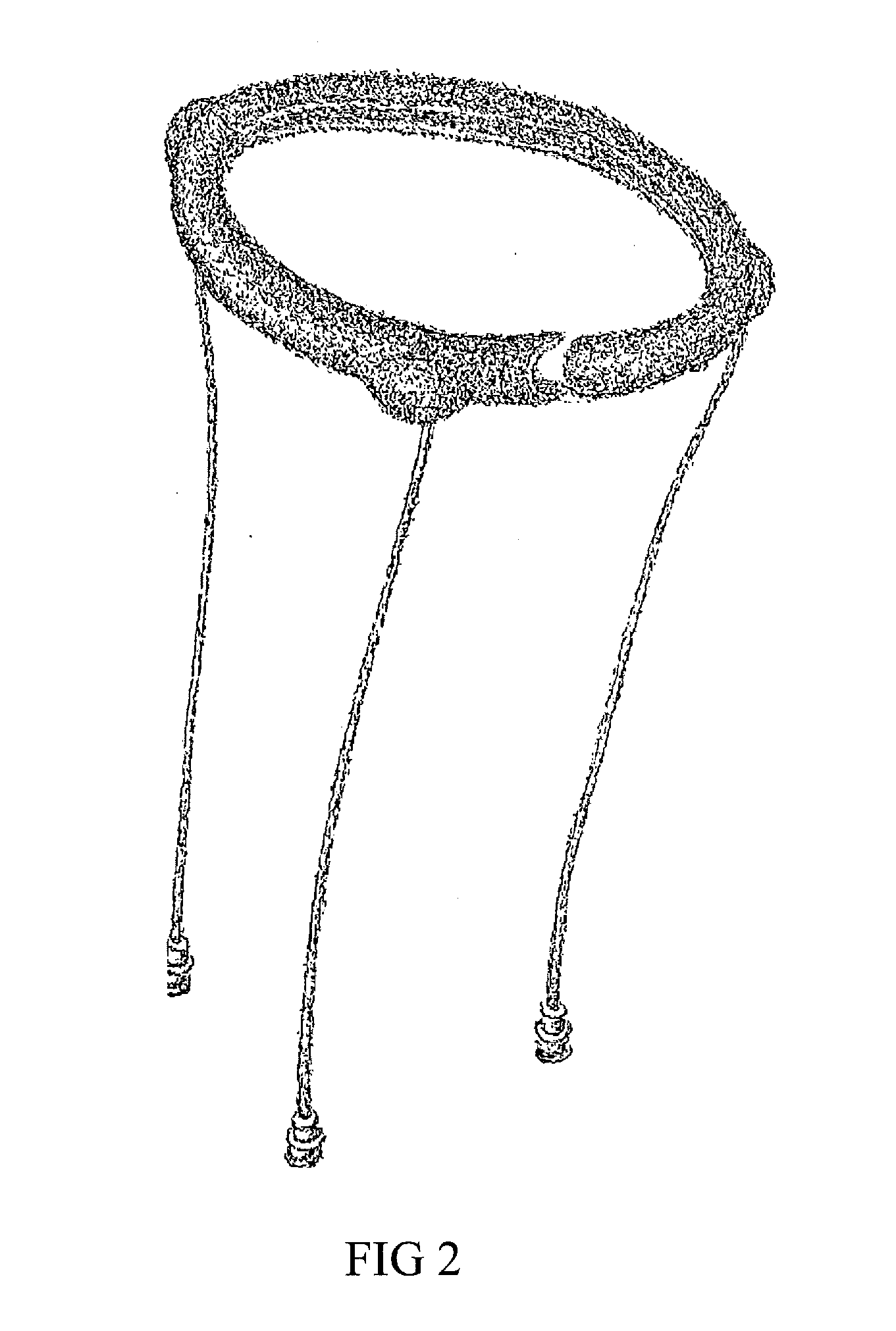 Device and Method for Tissue Displacement in Brachytherapy