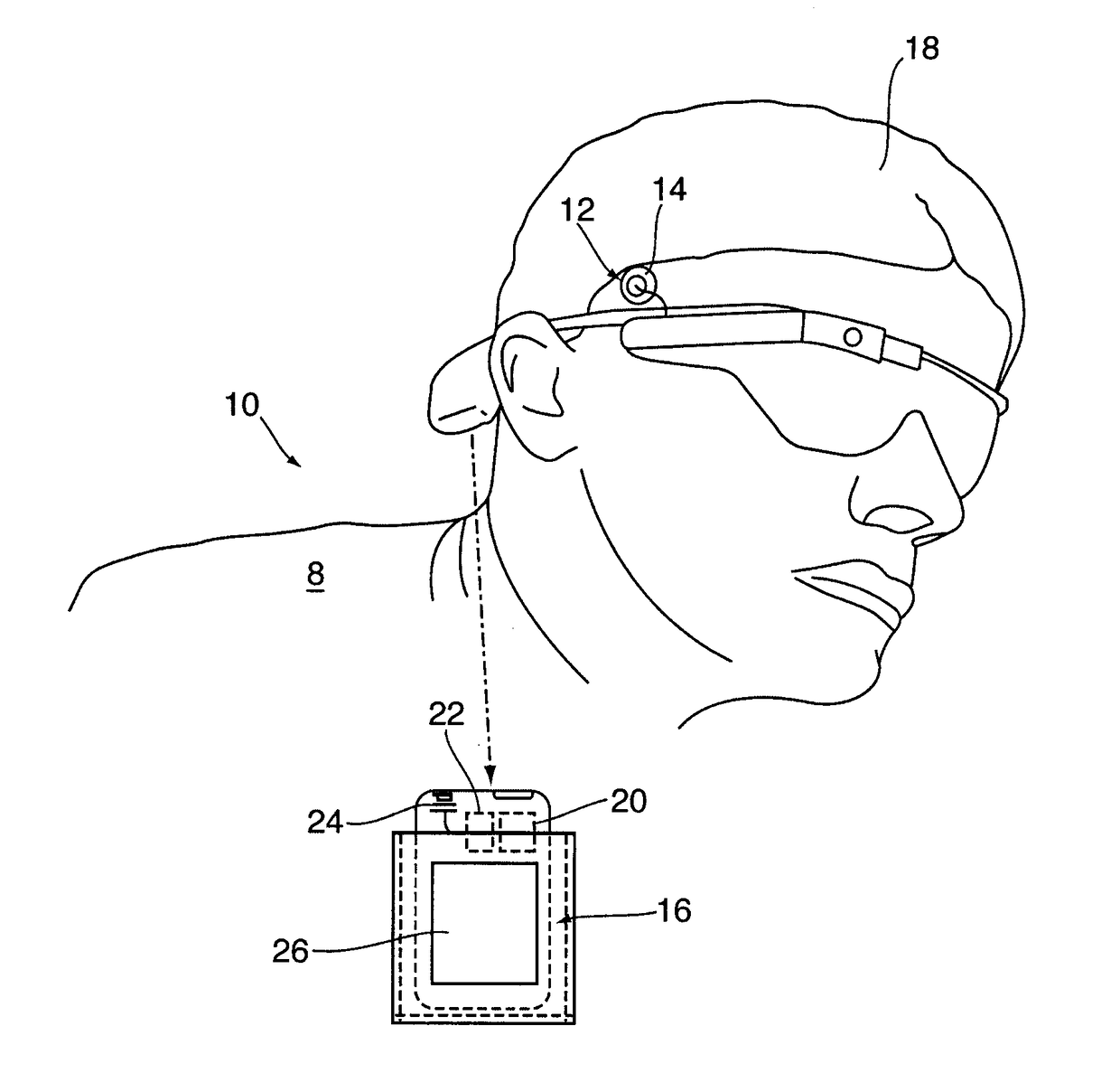 Method and apparatus for prediction of epileptic seizures