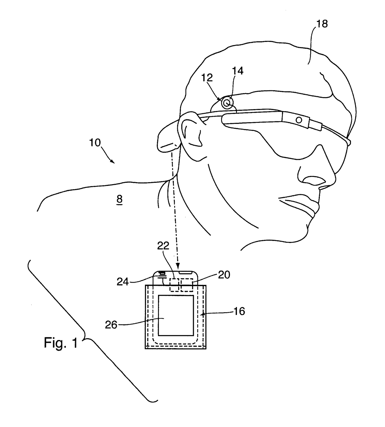 Method and apparatus for prediction of epileptic seizures