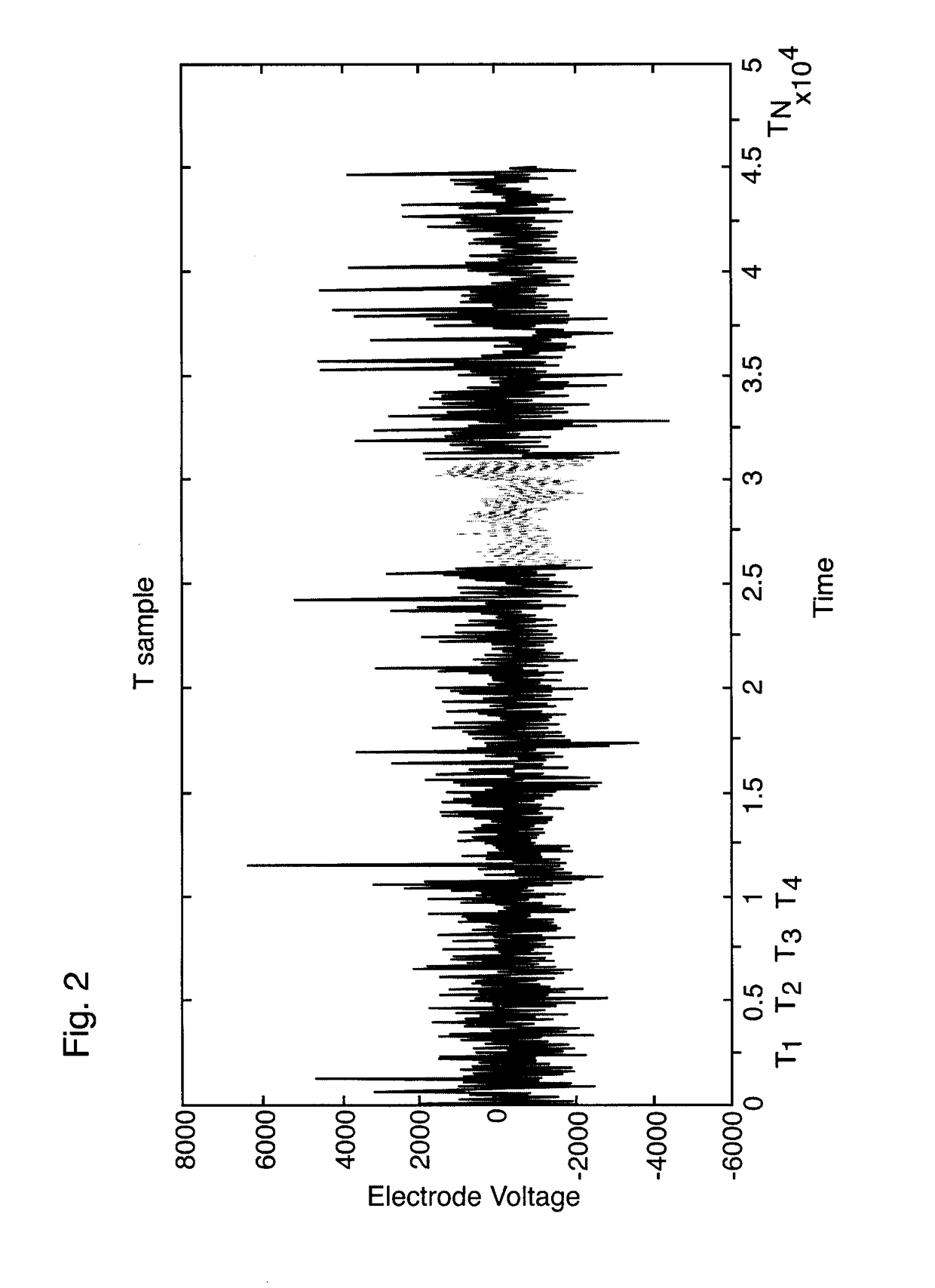 Method and apparatus for prediction of epileptic seizures