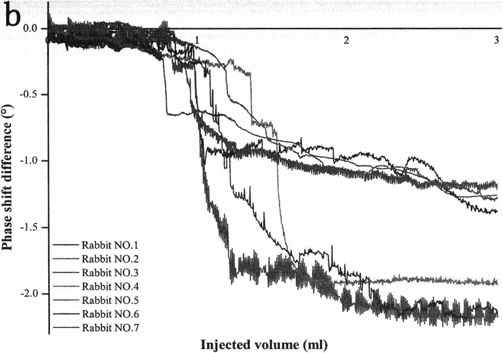 Contralateral-hemisphere-counteraction-based method for non-contact magnetic induction cerebral hemorrhage detection