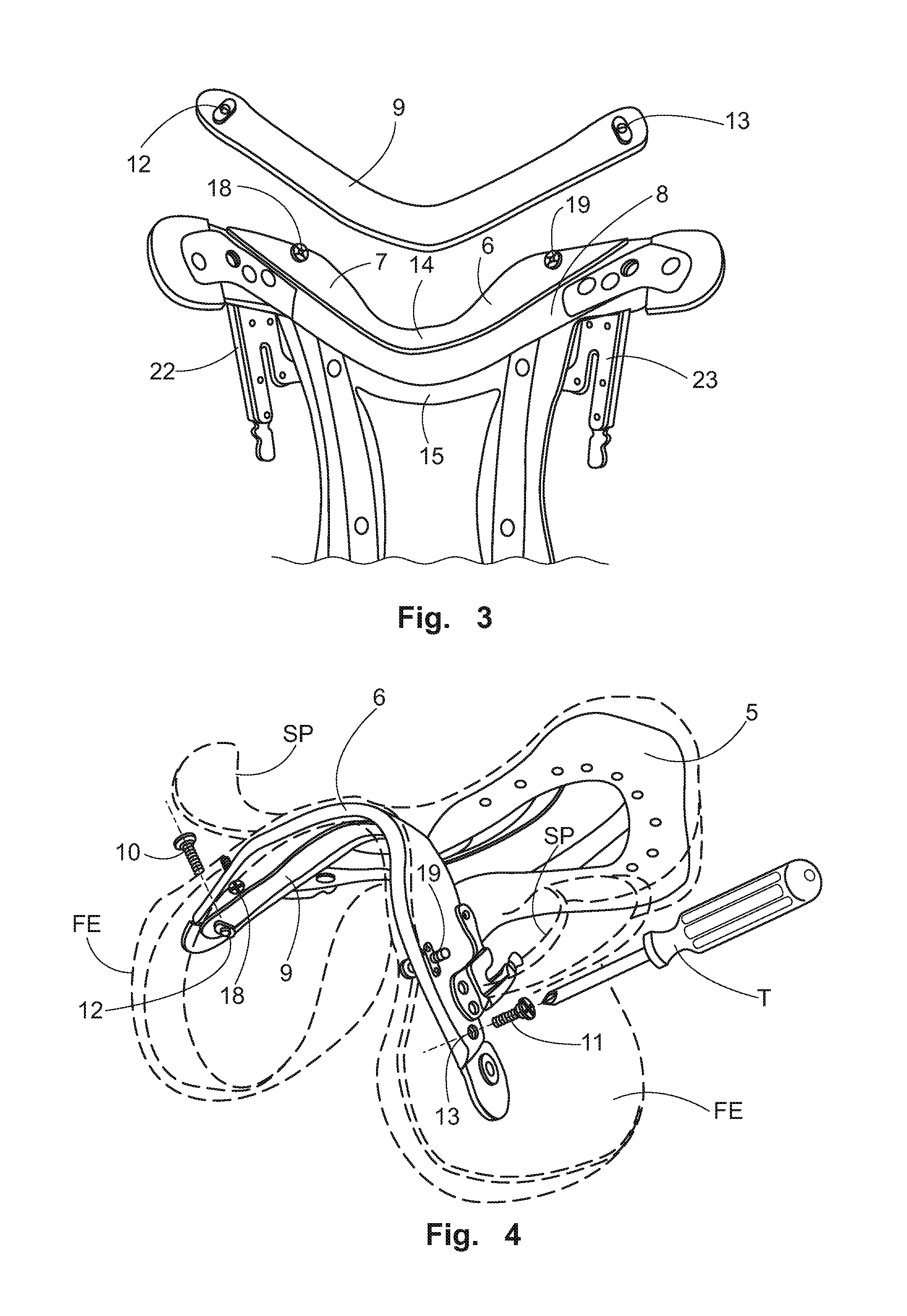 Adjustable saddle and adjusting assembly