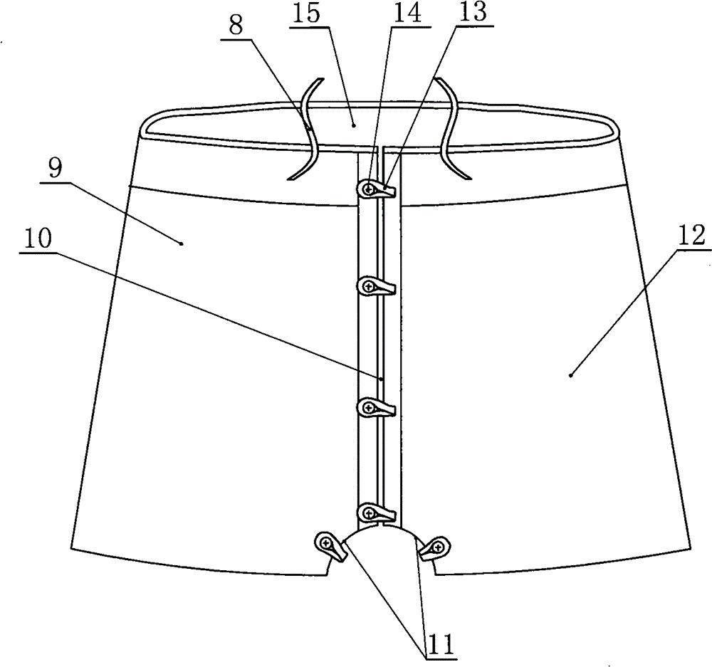 Post-operation fixing belt for abdominal-perineal rectal cancer colostomy