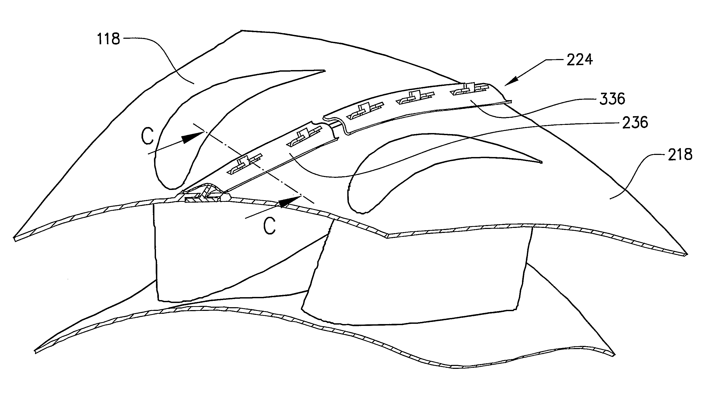 Gas turbine housing component