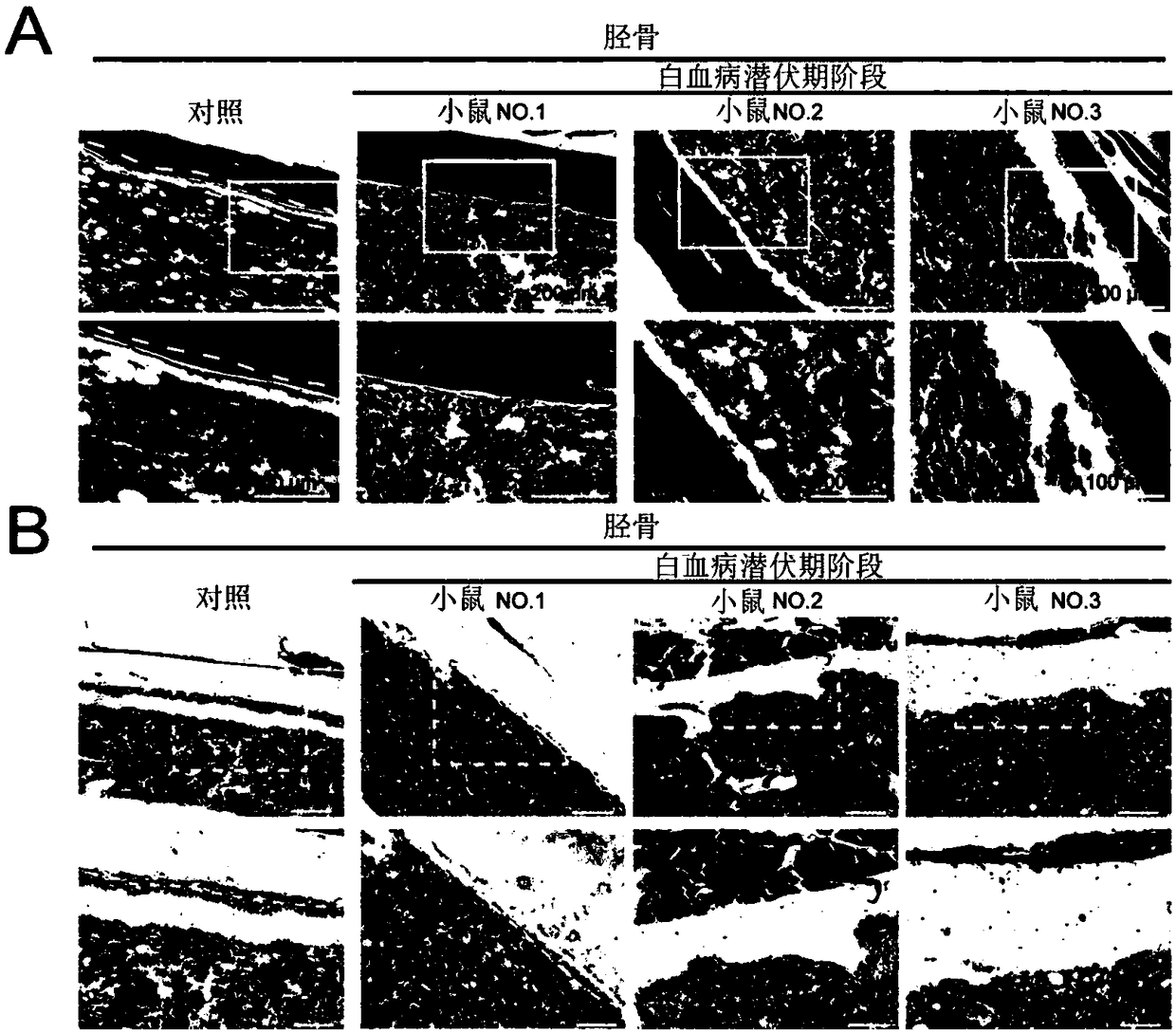 Method for rebuilding marrow microenvironment