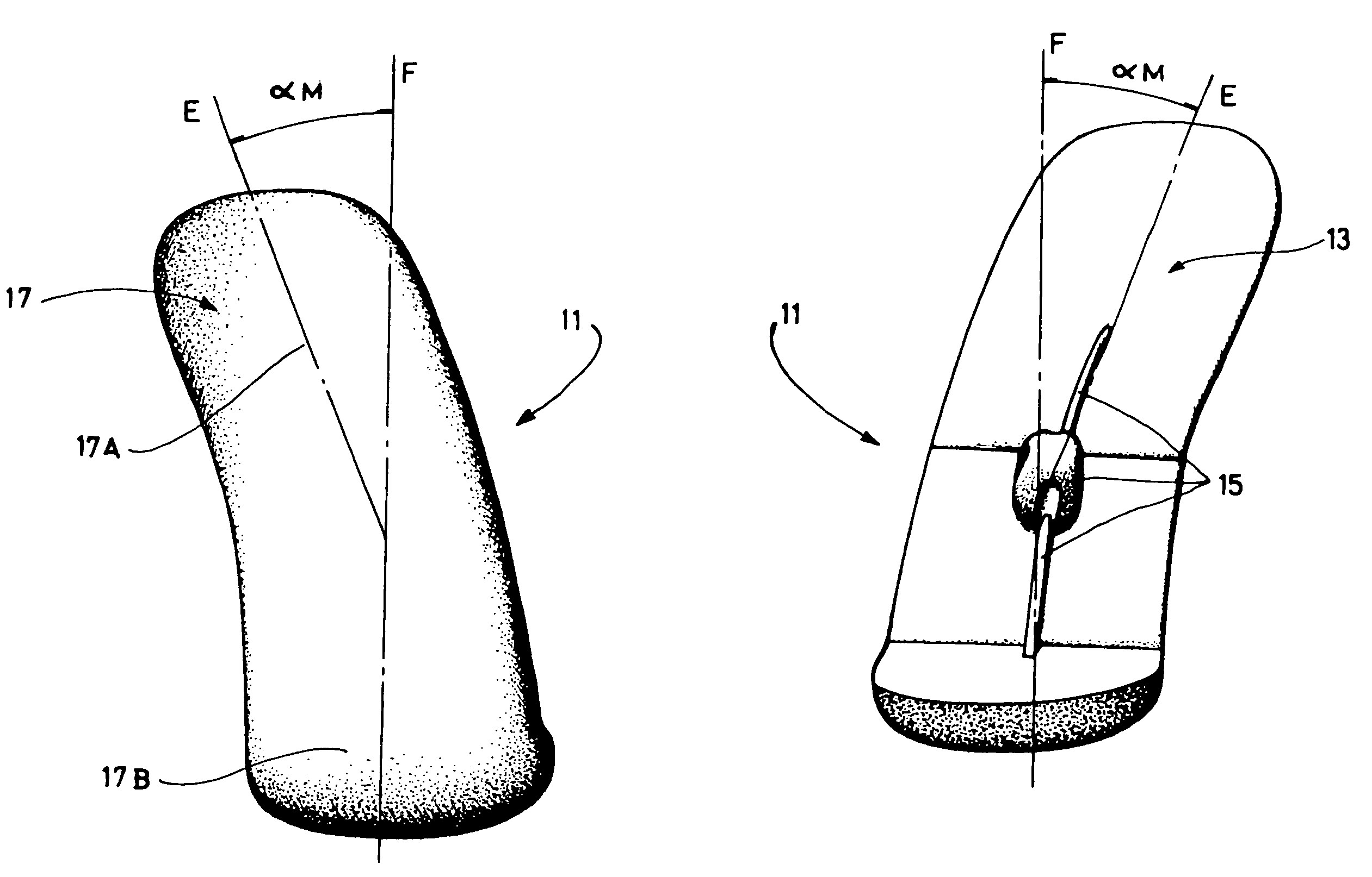 Medial and lateral femoral implants for single-compartment knee prosthesis