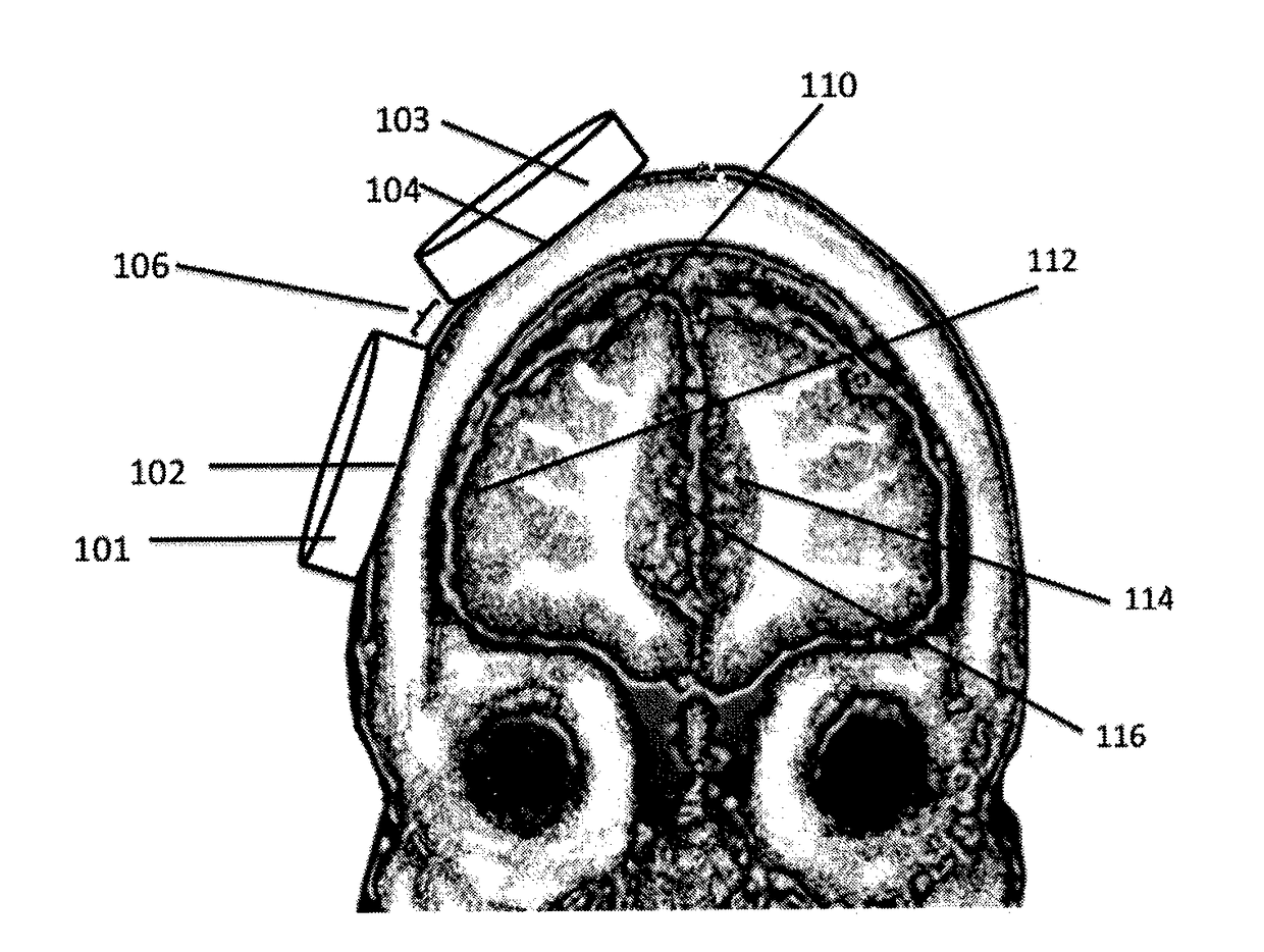 Control of spike-timing dependent brain network plasticity via multi-coil transcranial magnetic stimulation