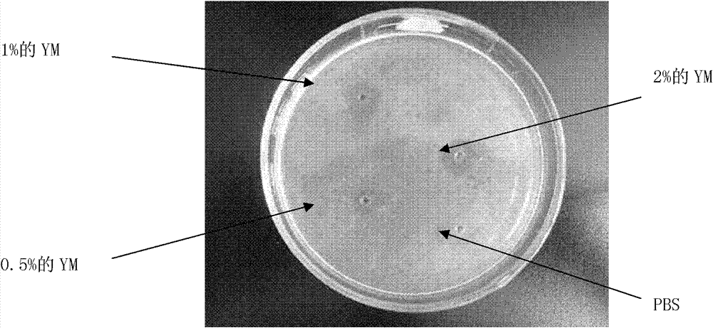 Novel application of Jingzhaotoxin