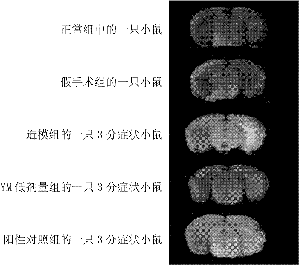 Novel application of Jingzhaotoxin