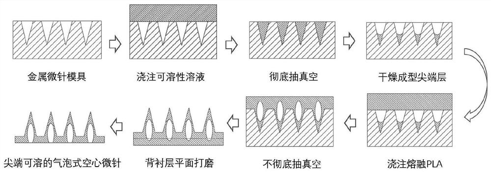 Method for preparing bubble-type hollow drug delivery microneedles by tip dissolution method