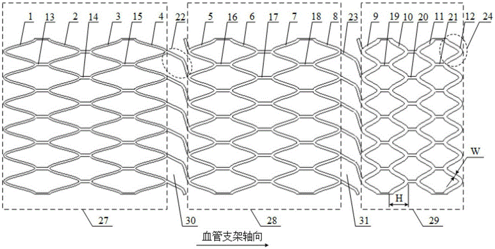 Stepped balloon dilatation vascular stent