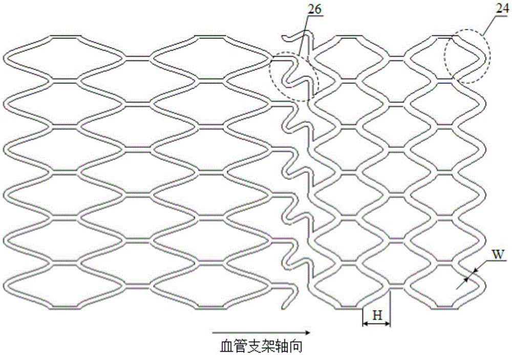 Stepped balloon dilatation vascular stent