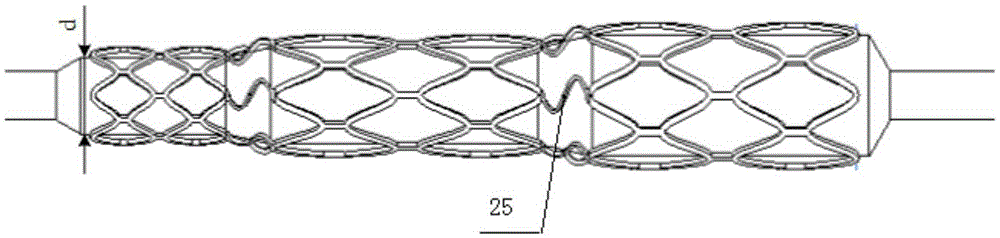 Stepped balloon dilatation vascular stent