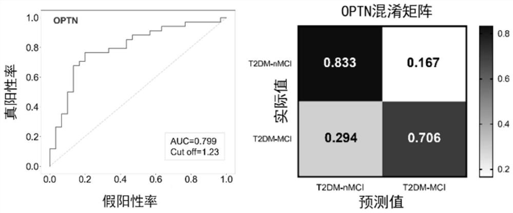 Biomarkers and kits for predicting the risk of MCI in patients with type 2 diabetes and their application