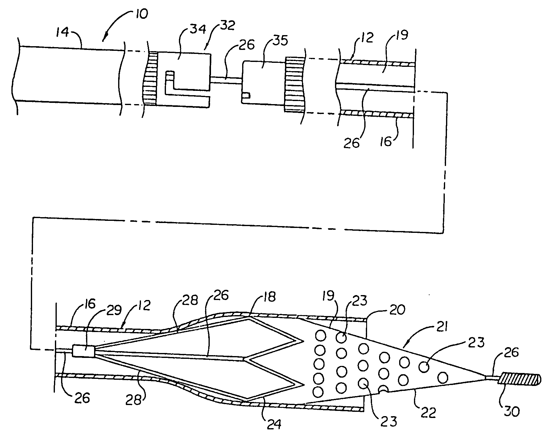 Intravascular filter and method