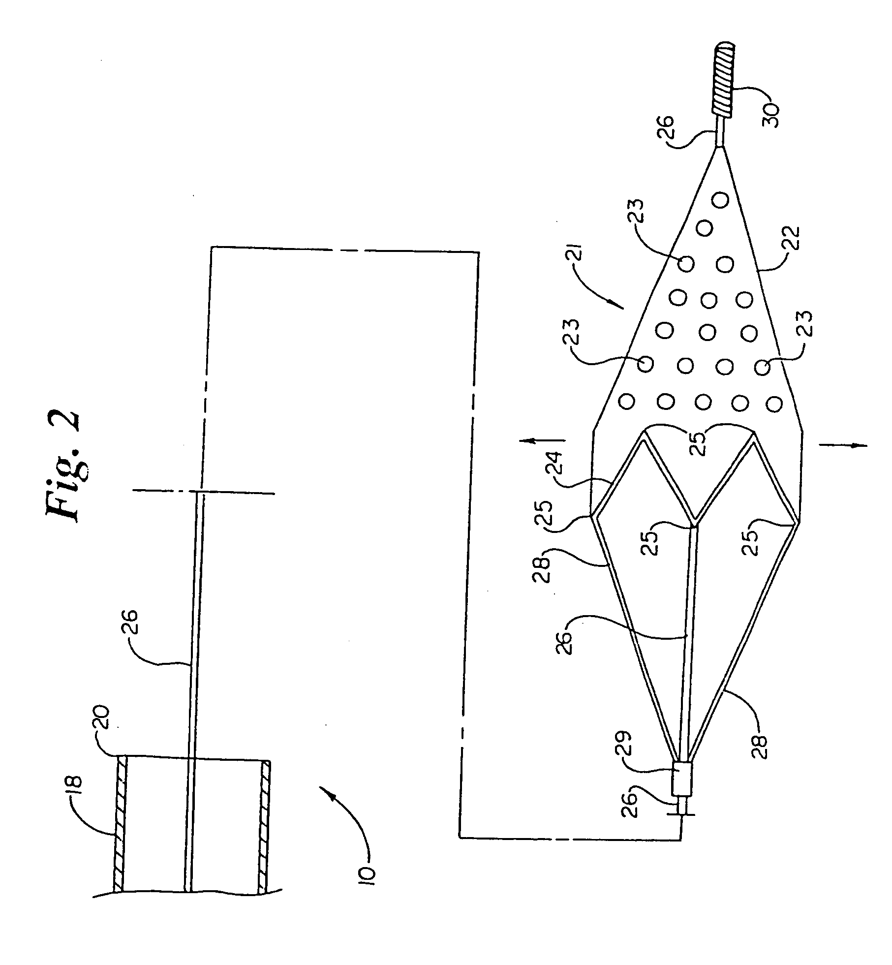 Intravascular filter and method