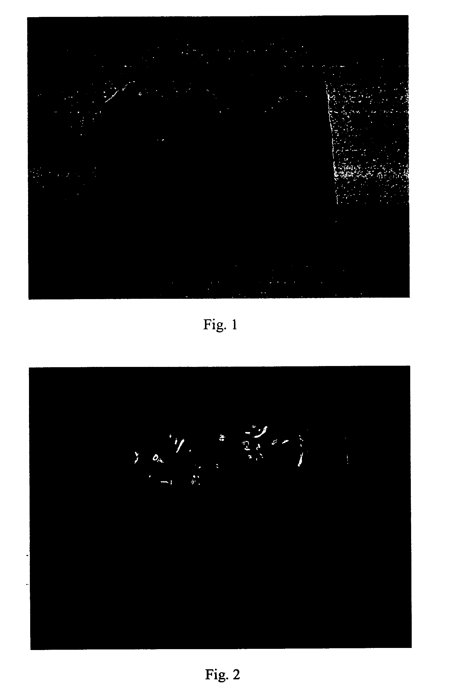 System and method for palatal expansion