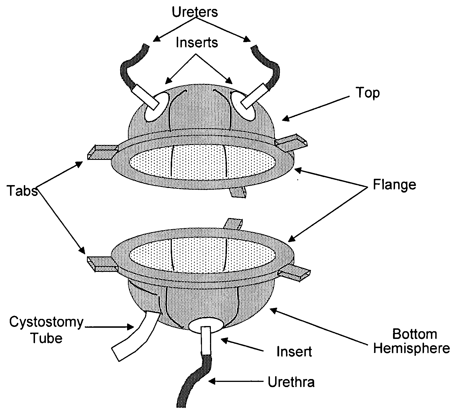 Scaffolds for organ reconstruction and augmentation