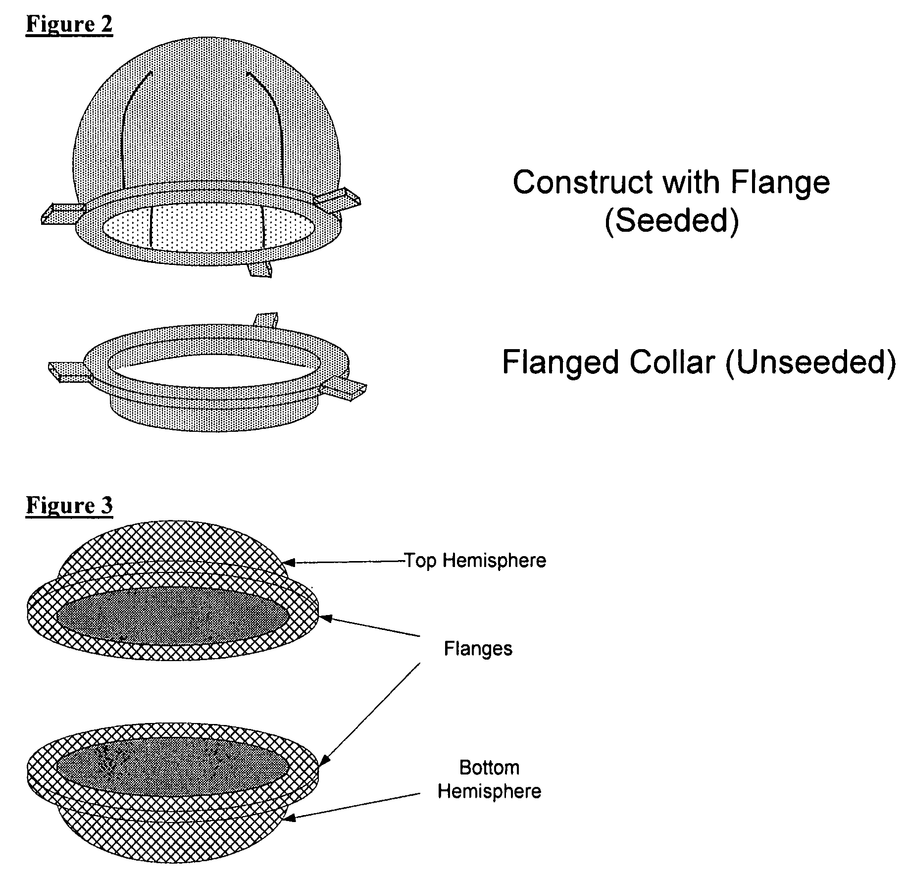 Scaffolds for organ reconstruction and augmentation