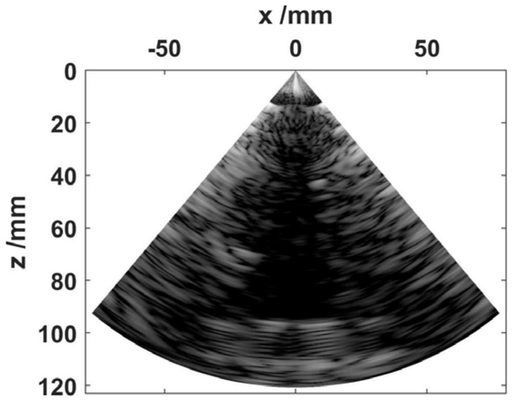 High-quality imaging method and system for bolt ultrasonic detection