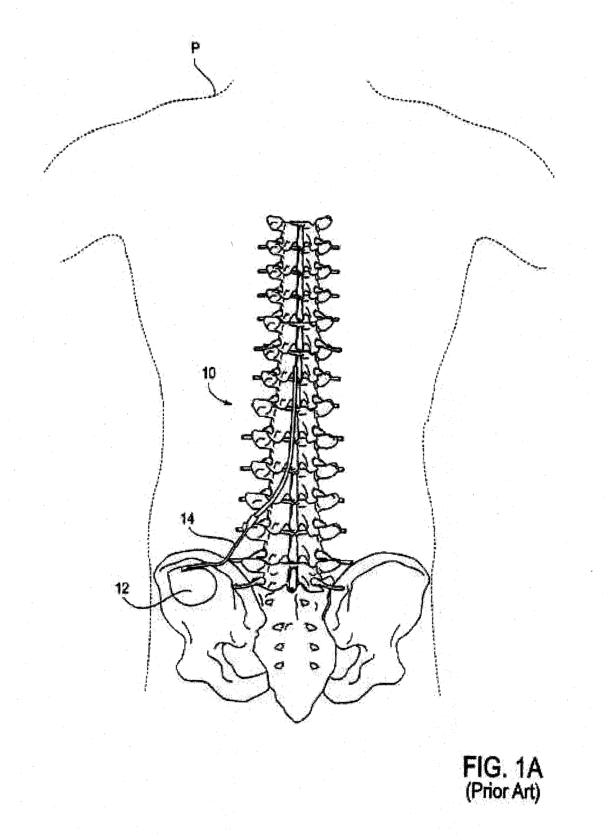 Articulable introducer sheath