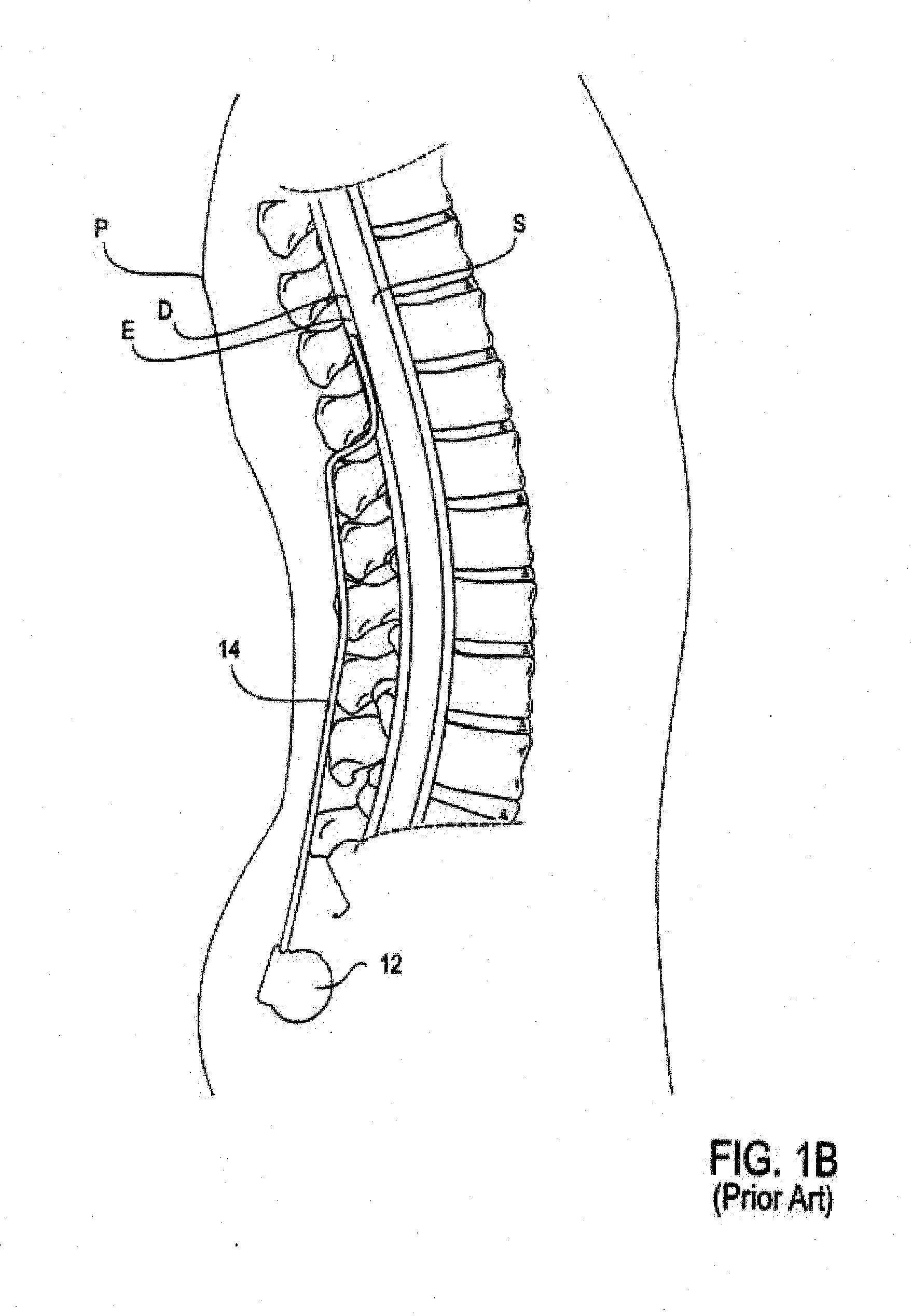 Articulable introducer sheath