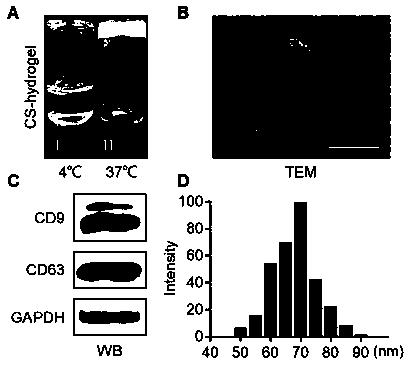 Technical means for thermo-responsive hydrogel package delivery of exosomes and treatment effect enhancement