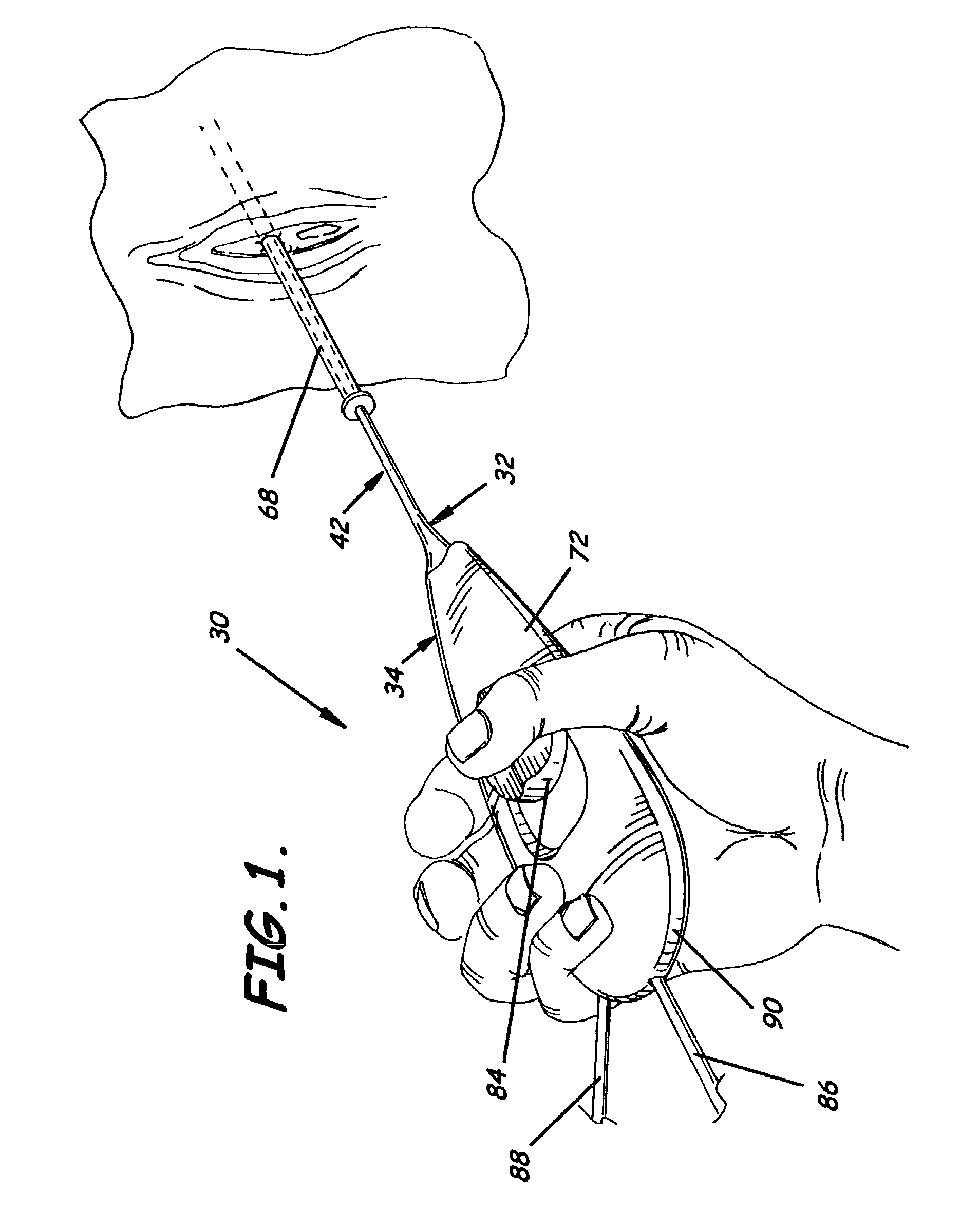 Steerable dilatation system, dilator, and related methods for stepped dilatation