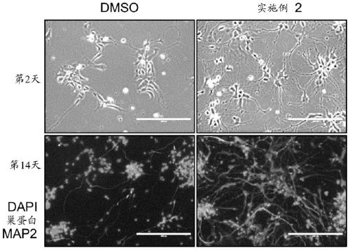 Inhibitors of rho associated coiled-coil containing protein kinase