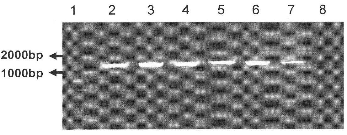 A Universal Nest-PCR Primer Set for Amplifying the gp90 Gene of Major Classical Strains of Equine Infectious Anemia Virus