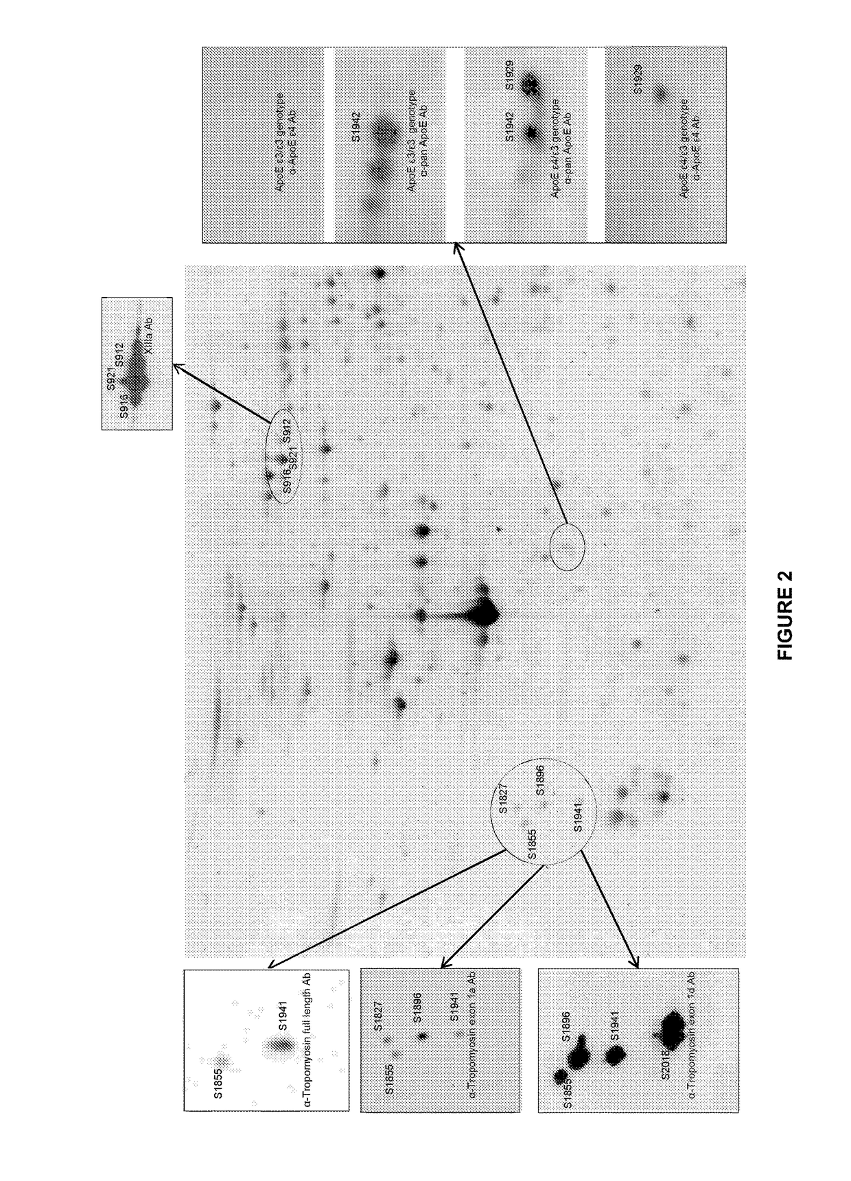 Method for aiding diagnosis of Alzheimer's disease