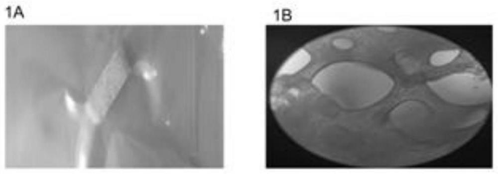 Construction method and application of PDX model based on osteogenic niche microenvironment modification