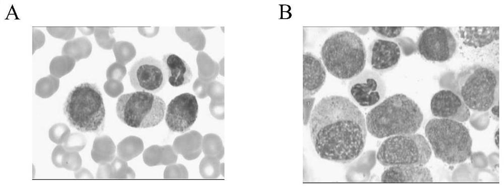 Construction method and application of PDX model based on osteogenic niche microenvironment modification