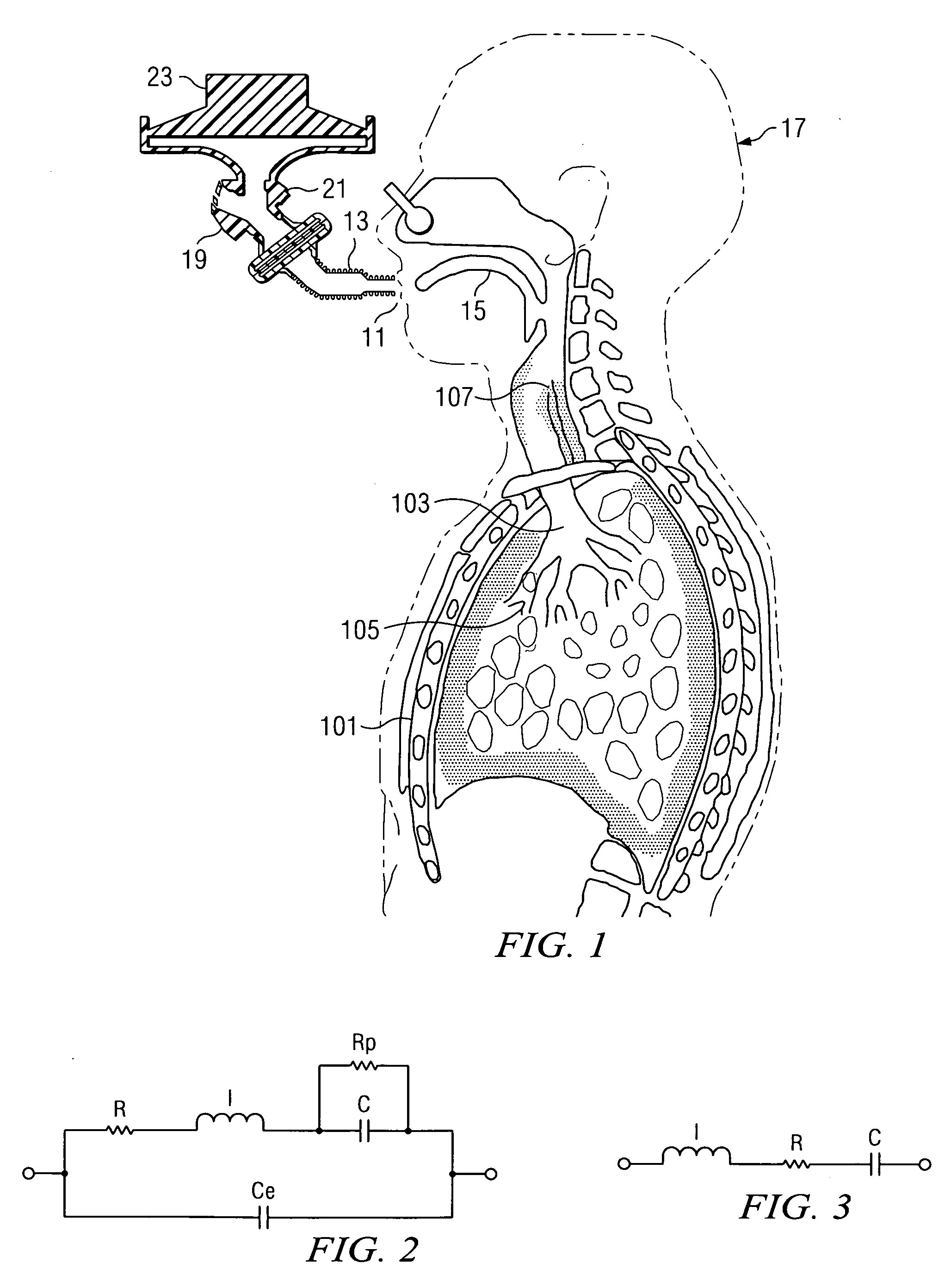 Augmented RIC model of respiratory systems