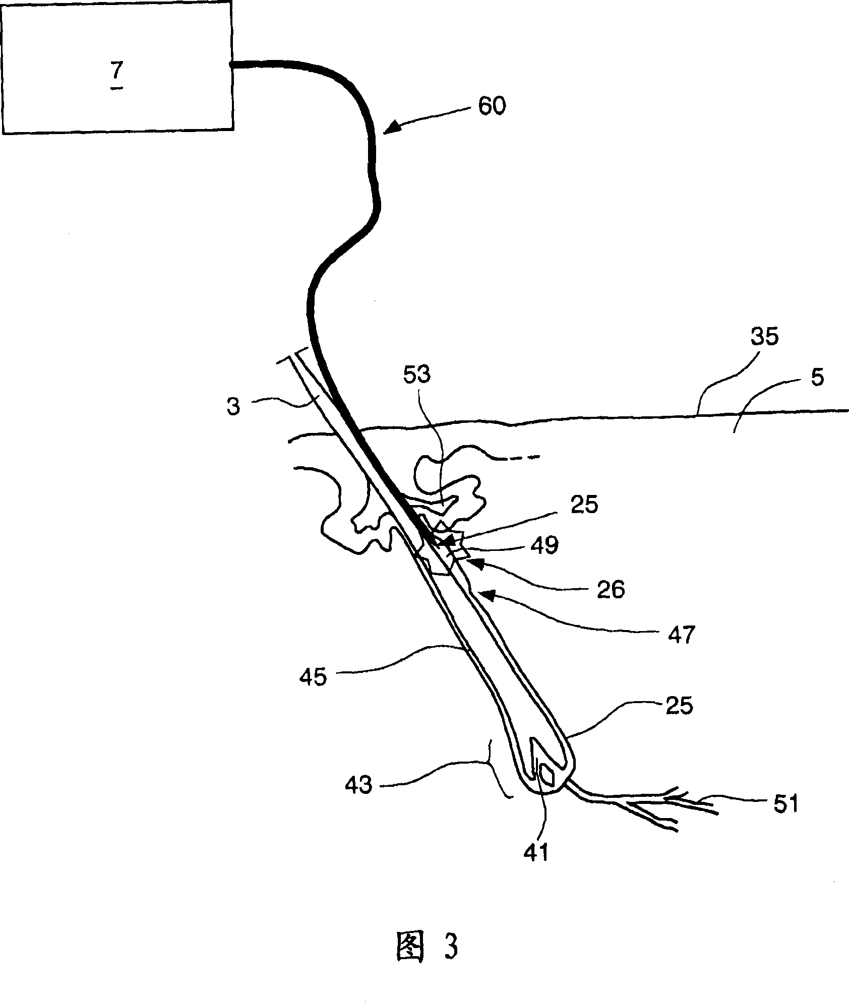 Hair-growth control device and hair-growth control method