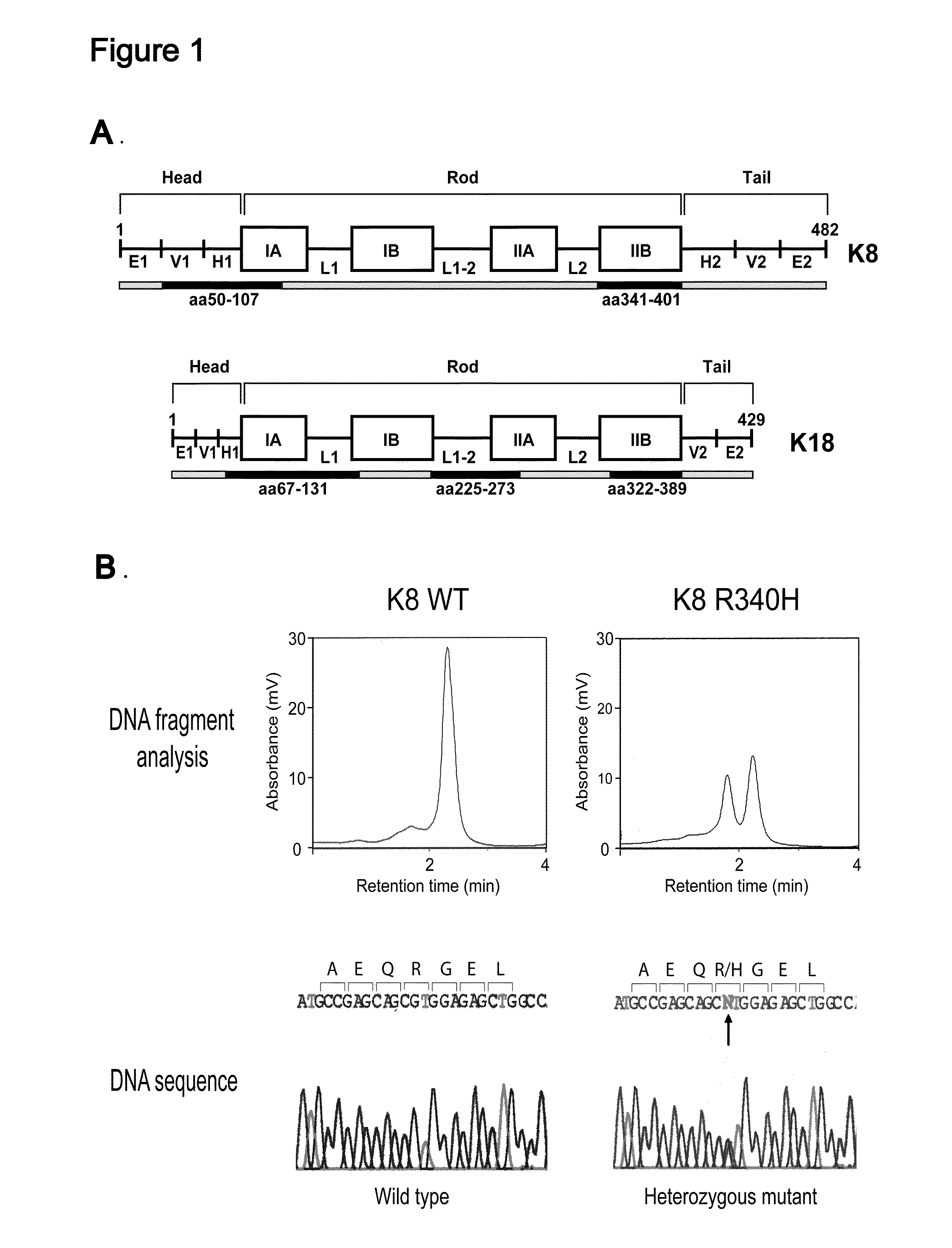 Keratin 8 Mutations are Risk Factors for Developing Liver Disease of Multiple Etiologies