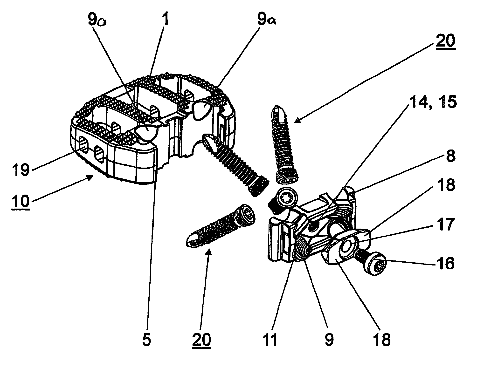 Intervertebral implant