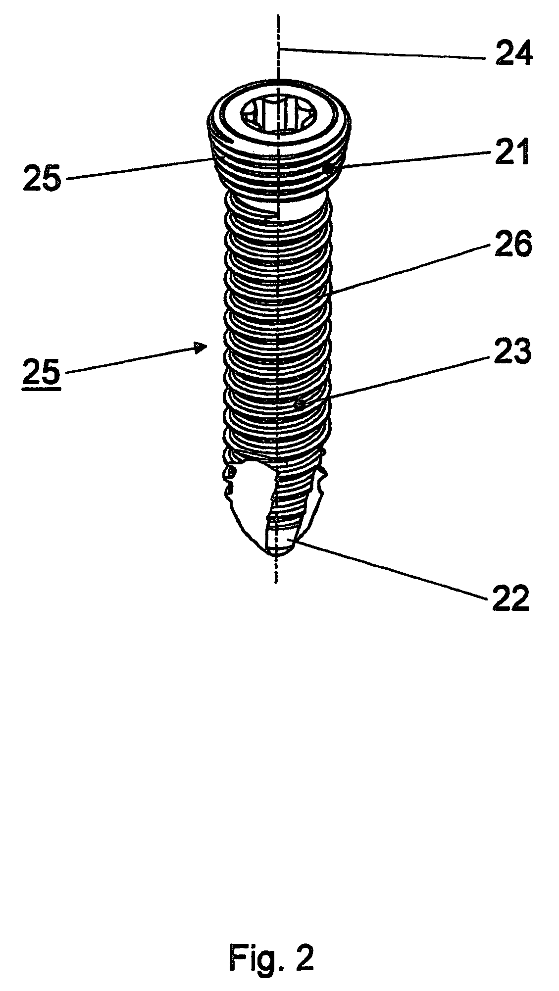 Intervertebral implant