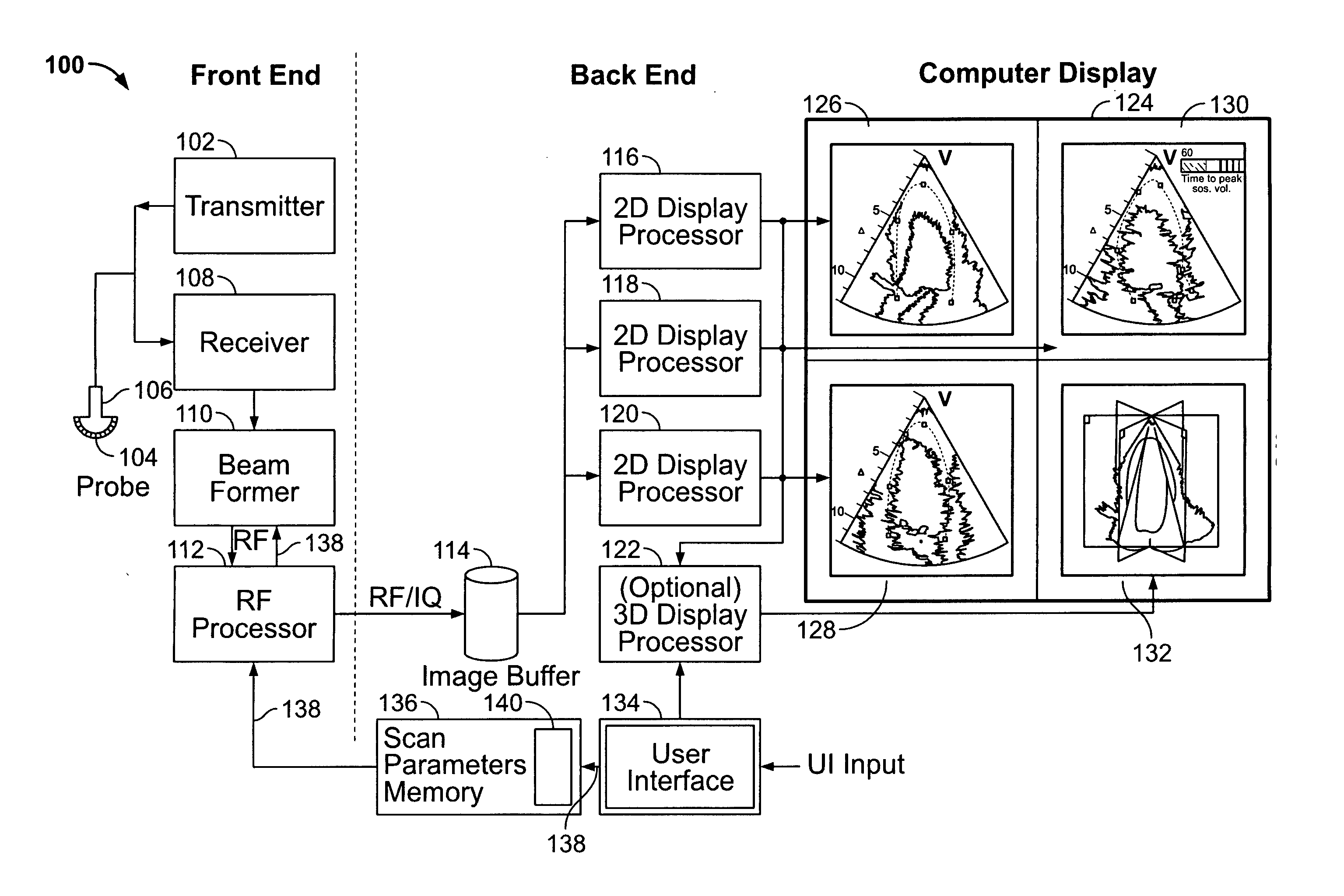 Methods and apparatus for defining a protocol for ultrasound imaging