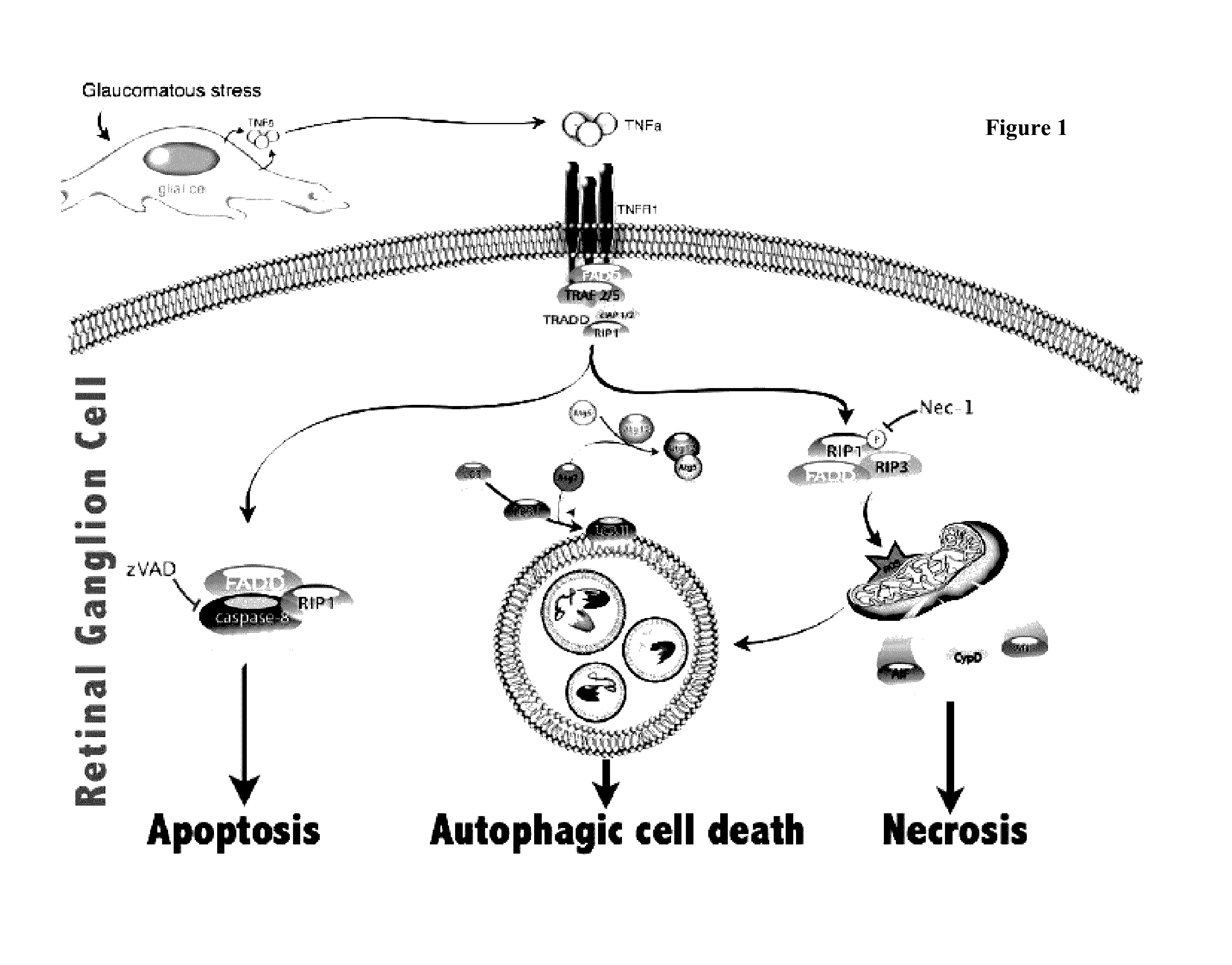 Methods and compositions for preserving retinal ganglion cells