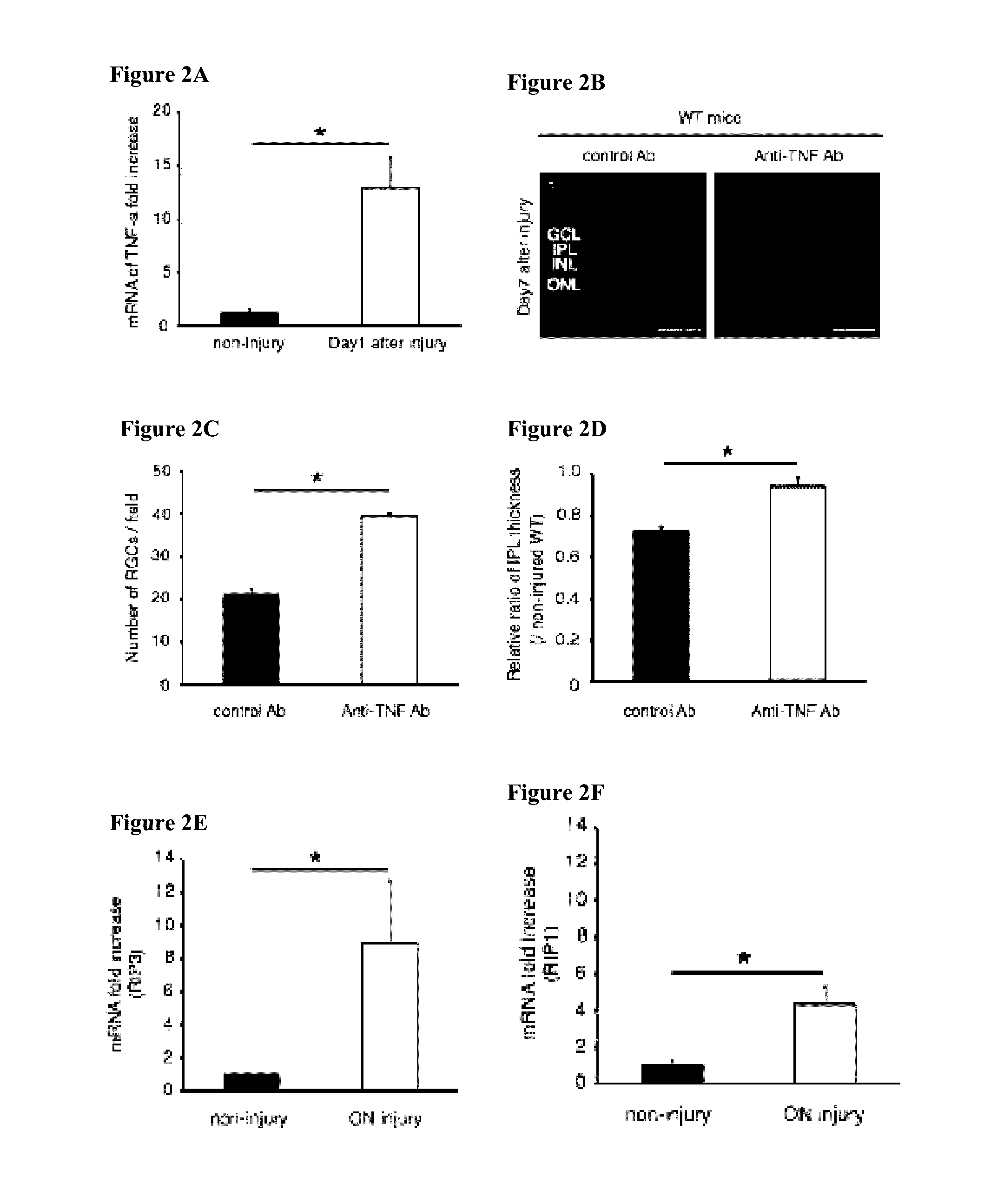 Methods and compositions for preserving retinal ganglion cells