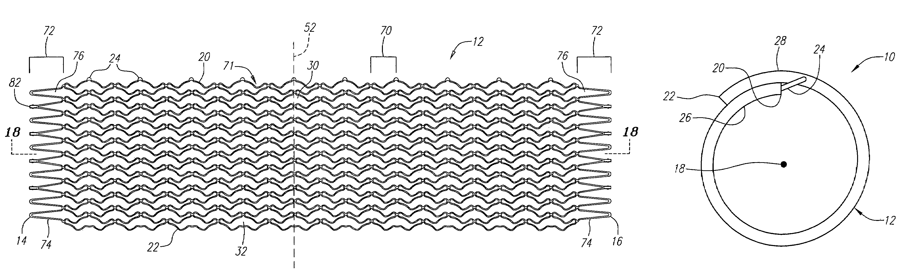 Coiled-sheet stent with flexible mesh design