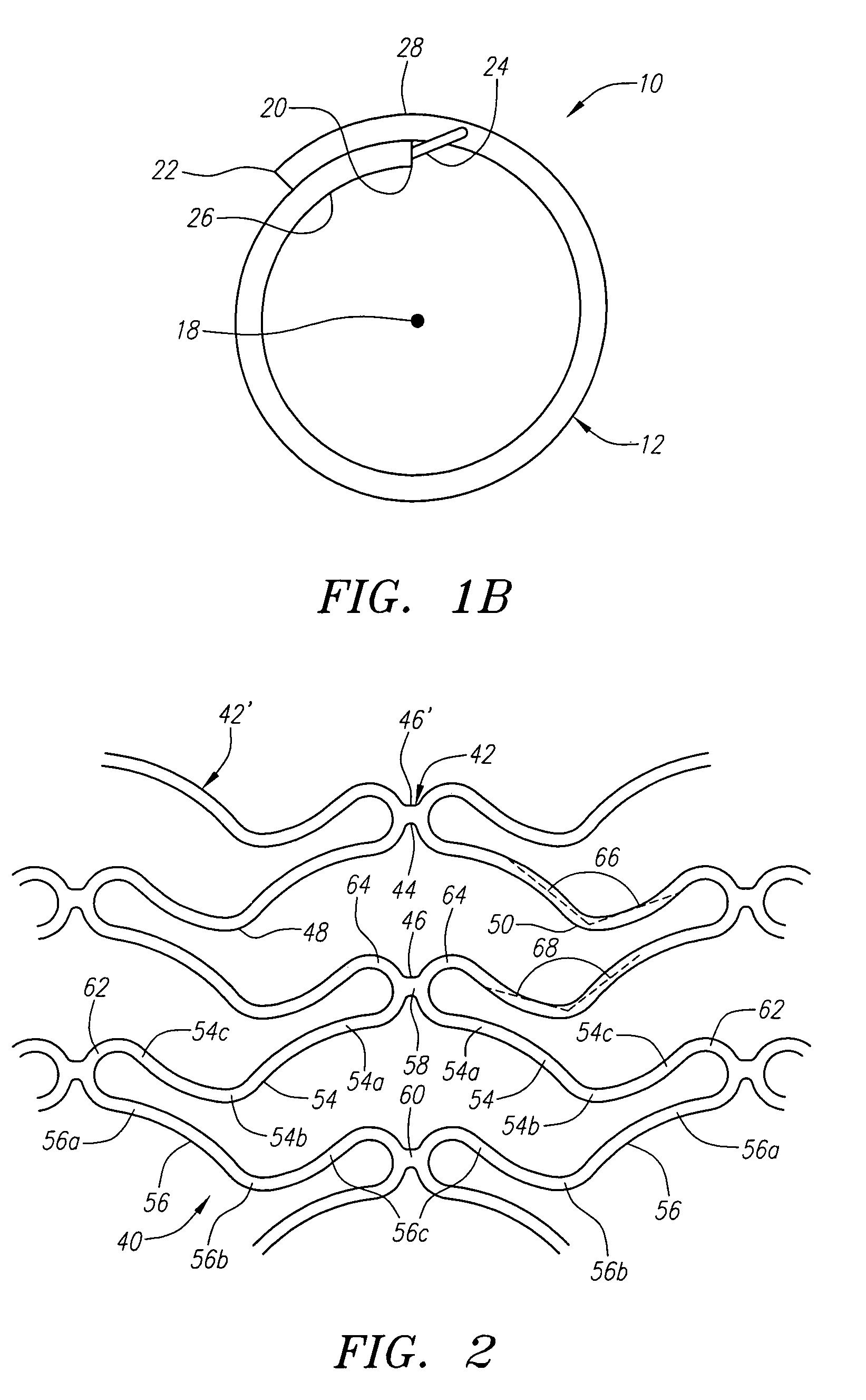 Coiled-sheet stent with flexible mesh design