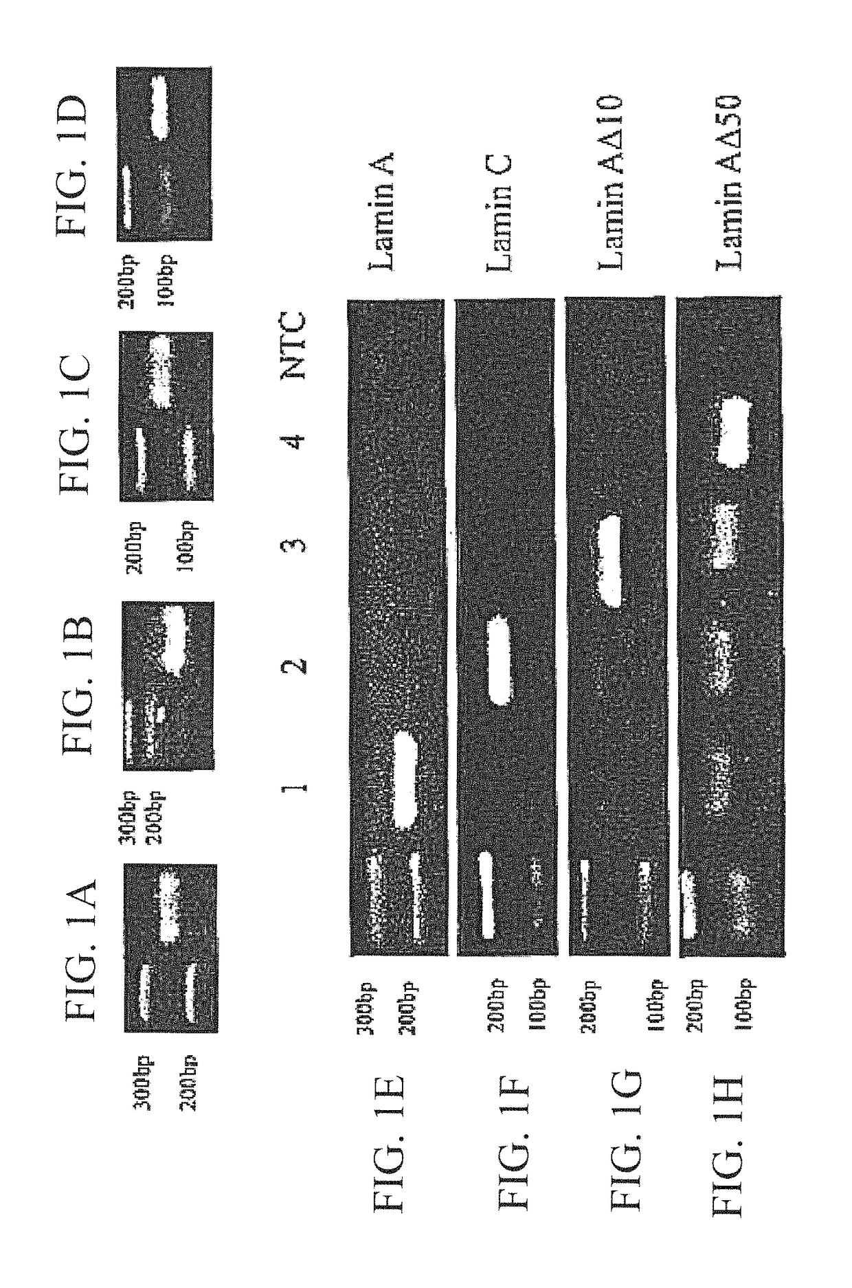 Quantification of Lamin C and Lamin A for tumor classification