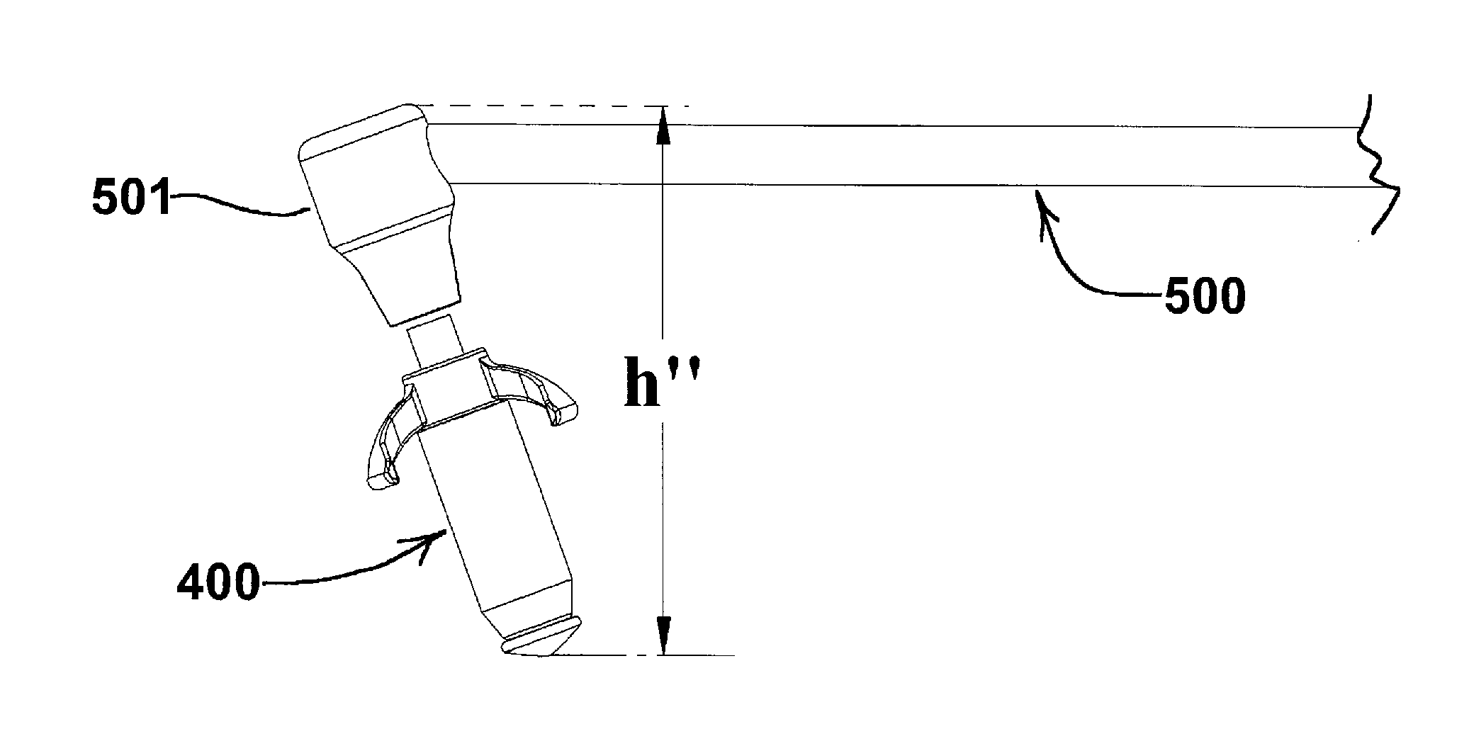 Devices and Methods for Dilating a Paranasal Sinus Opening and for Treating Sinusitis